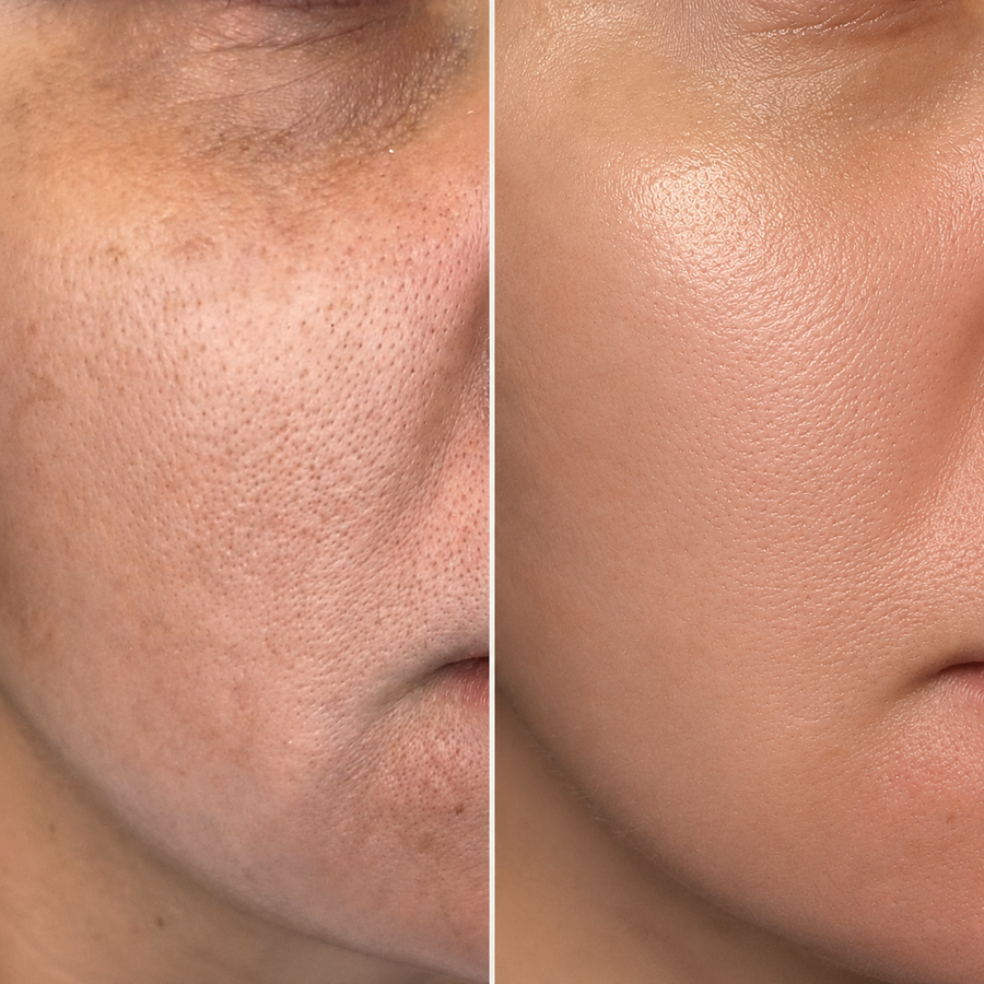 PORES VISIBLEMENT AFFINÉS